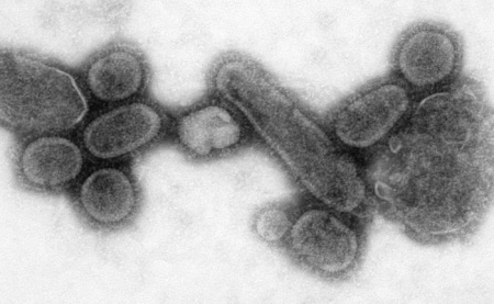 Reconstrucción del virus de la mal llamada gripe española
